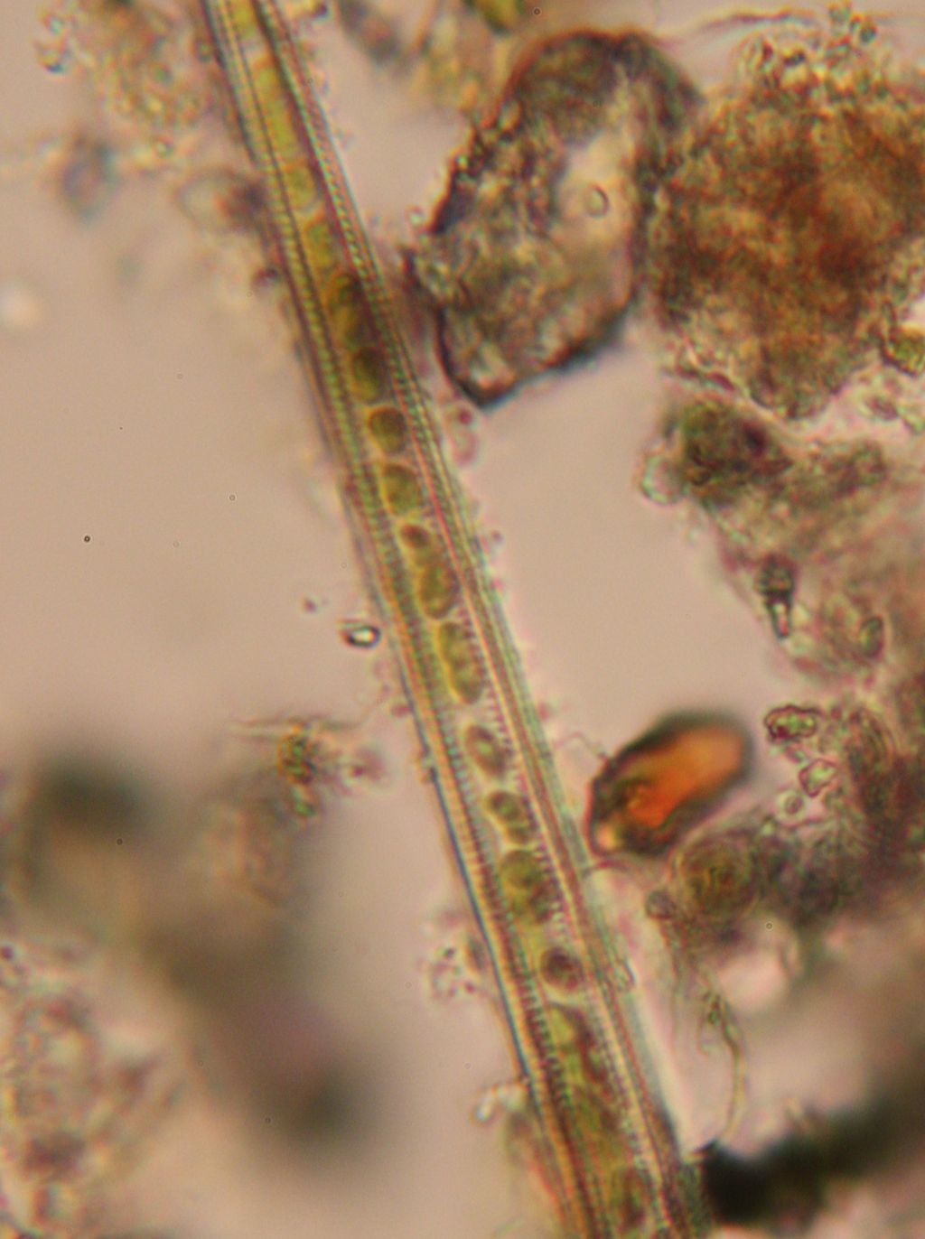 spirogyra